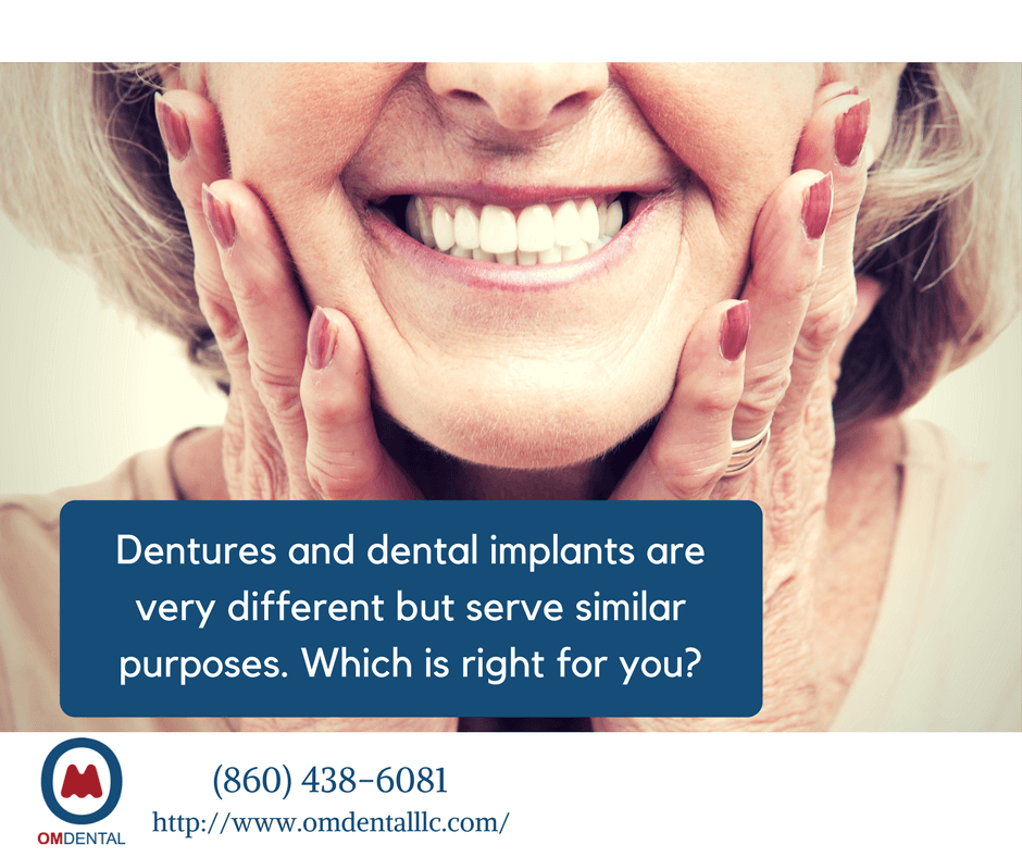 Know the Difference Between Dentures and Dental Implants